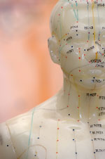 FAQ About Acupuncture